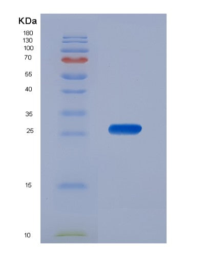 Human BAG2 (Bag Family Molecular Chaperone Regulator 2) - Recombinant Protein