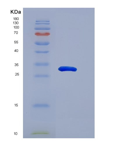 Human SNAI1 (Zinc Finger Protein Snai1) - Recombinant Protein