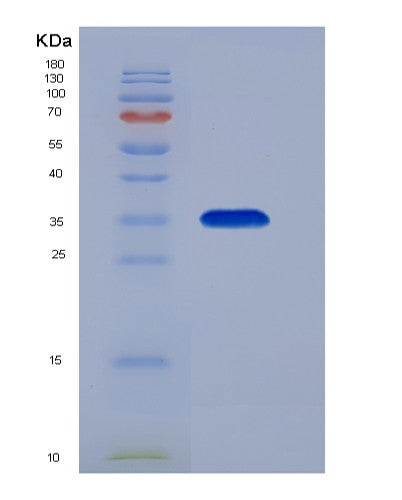 Human MBD3 (Methyl-Cpg-Binding Domain Protein 3) - Recombinant Protein