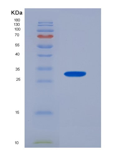 Human PAK4 (Serine/Threonine-Protein Kinase Pak 4) - Recombinant Protein
