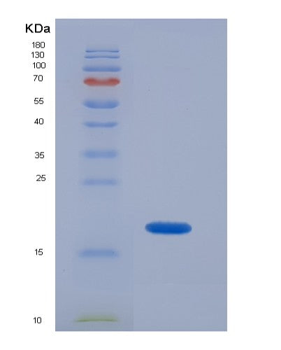 Human SOD1 (Superoxide Dismutase [Cu-Zn]) - Recombinant Protein