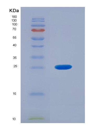 Human OTC (Ornithine Transcarbamylase, Mitochondrial) - Recombinant Protein