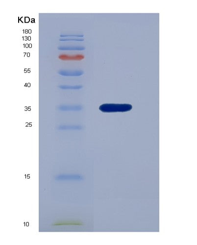 Human PNP (Purine Nucleoside Phosphorylase) - Recombinant Protein