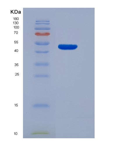 Human HPRT1 (Hypoxanthine-Guanine Phosphoribosyltransferase) - Recombinant Protein