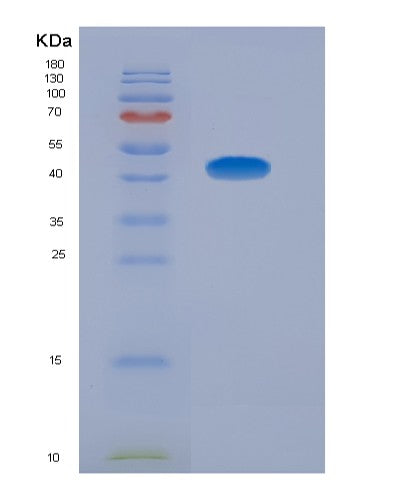Human GOT2 (Aspartate Aminotransferase, Mitochondrial) - Recombinant Protein
