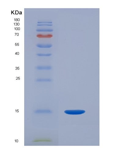 Human HP (Haptoglobin) - Recombinant Protein