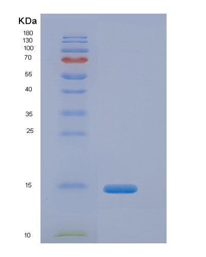 Human CFB (Complement Factor B) - Recombinant Protein