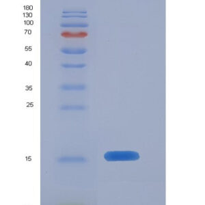 Human REN (Renin) - Recombinant Protein