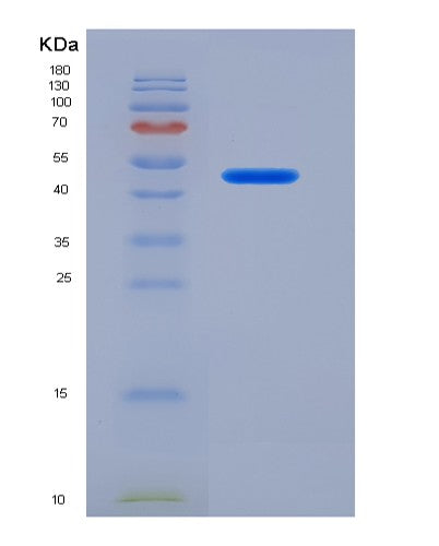 Human ASS1 (Argininosuccinate Synthase) - Recombinant Protein