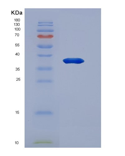 Human SPINK1 (Serine Protease Inhibitor Kazal-Type 1) - Recombinant Protein