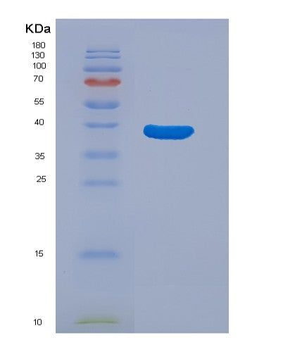 Human C3 (Complement C3) - Recombinant Protein