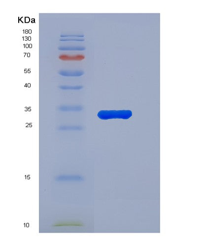 Human C5 (Complement C5) - Recombinant Protein