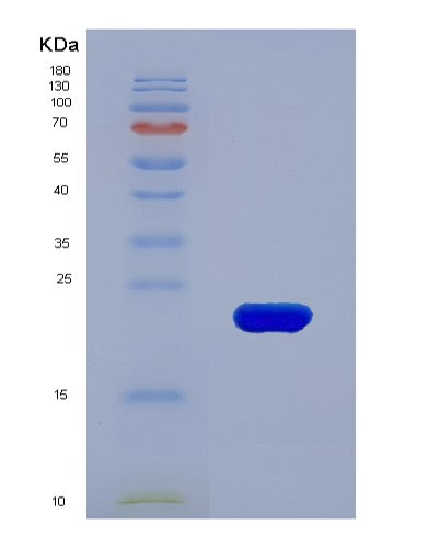 Human TIMP1 (Metalloproteinase Inhibitor 1) - Recombinant Protein