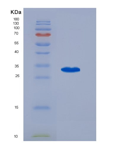 Human PRKAA1 (5'-Amp-Activated Protein Kinase Catalytic Subunit Alpha-1) - Recombinant Protein