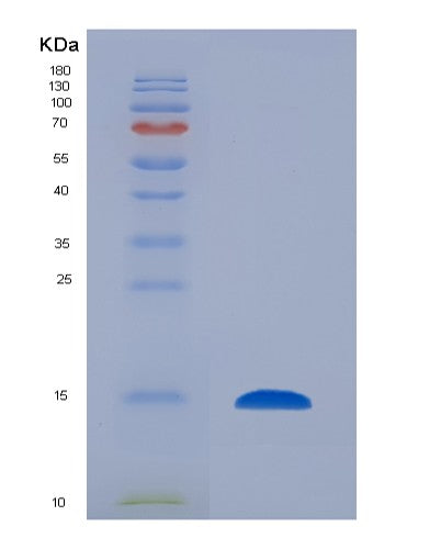 Human CST4 (Cystatin-S) - Recombinant Protein