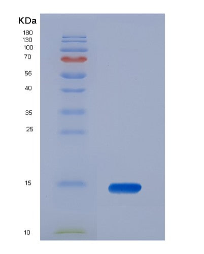 Human HRAS (Gtpase Hras) - Recombinant Protein