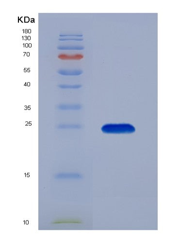 Human KRAS (Gtpase Kras) - Recombinant Protein