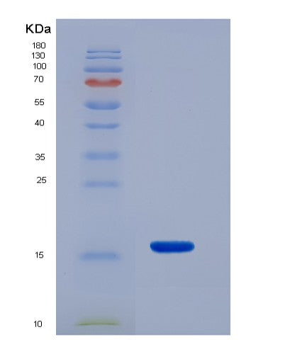 Human GNRH1 (Progonadoliberin-1) - Recombinant Protein