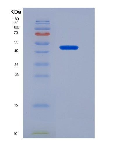 Human OXT (Oxytocin-Neurophysin 1) - Recombinant Protein