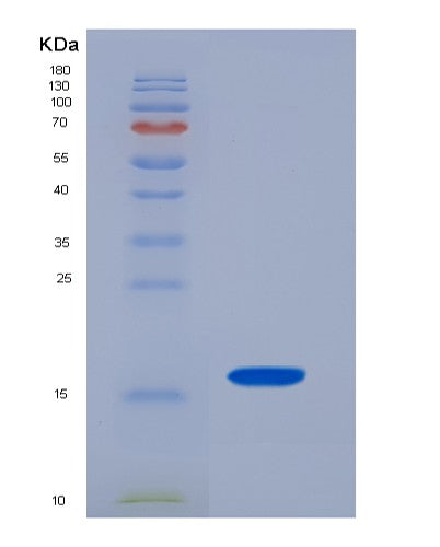 Human TSHB (Thyrotropin Subunit Beta) - Recombinant Protein