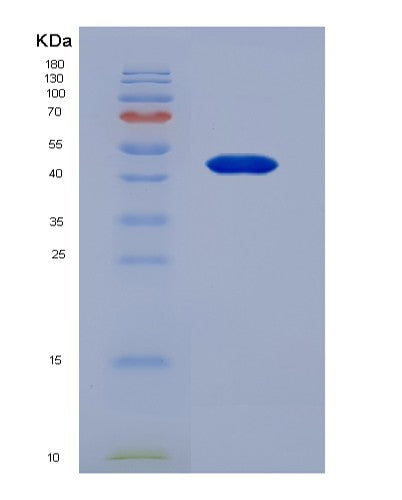 Human FGB (Fibrinogen Beta Chain) - Recombinant Protein