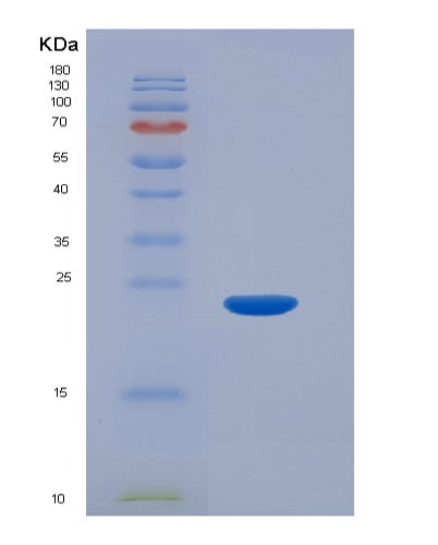 Human RBP4 (Retinol-Binding Protein 4) - Recombinant Protein