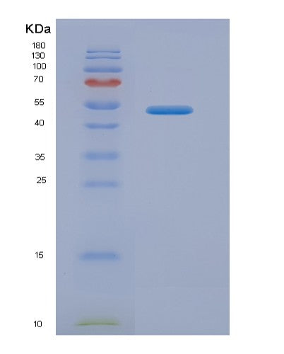 Human AMBP (Protein Ambp) - Recombinant Protein