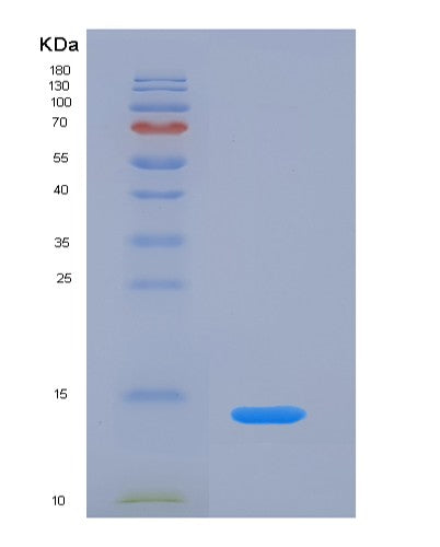 Human PPBP (Platelet Basic Protein) - Recombinant Protein
