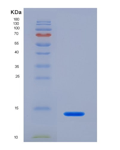 Human CXCL10 (C-X-C Motif Chemokine 10) - Recombinant Protein