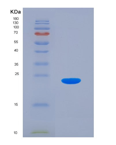 Human FTL (Ferritin Light Chain) - Recombinant Protein