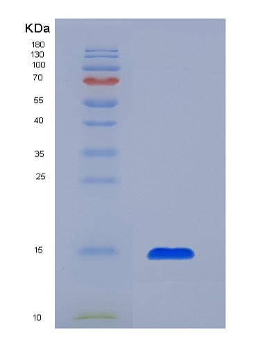 Human SLPI (Antileukoproteinase) - Recombinant Protein
