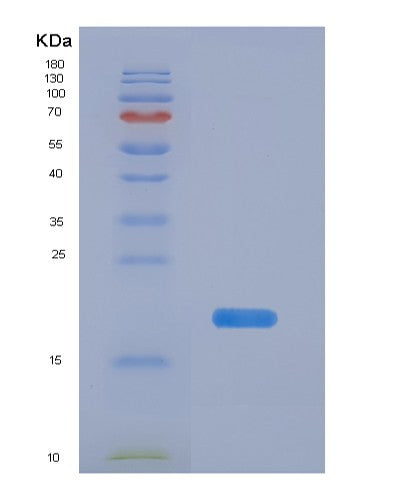Human VTN (Vitronectin) - Recombinant Protein