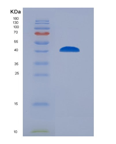 Human ANXA1 (Annexin A1) - Recombinant Protein