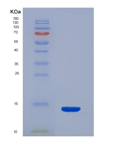 Human S100B (Protein S100-B) - Recombinant Protein