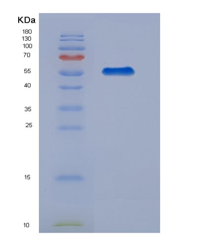 Human CAPNS1 (Calpain Small Subunit 1) - Recombinant Protein