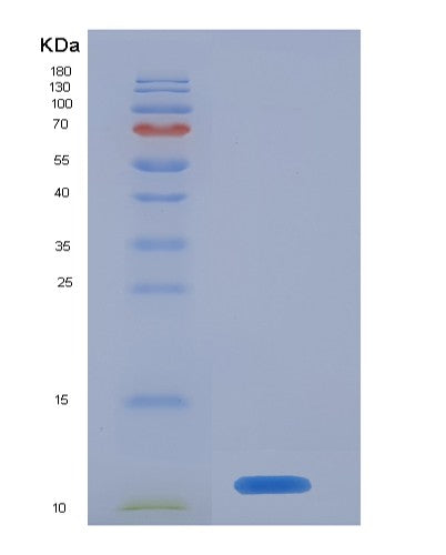 Human S100A8 (Protein S100-A8) - Recombinant Protein