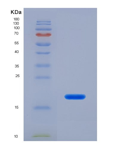 Human SERPING1 (Plasma Protease C1 Inhibitor) - Recombinant Protein