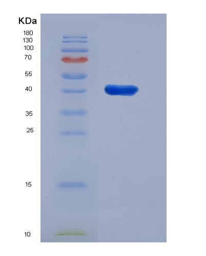 Mouse Got1 (Aspartate Aminotransferase, Cytoplasmic) - Recombinant Protein