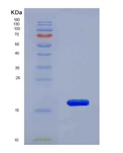 Human RPLP2 (Large Ribosomal Subunit Protein P2) - Recombinant Protein