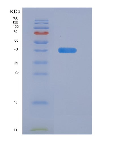 Human PTMA (Prothymosin Alpha) - Recombinant Protein