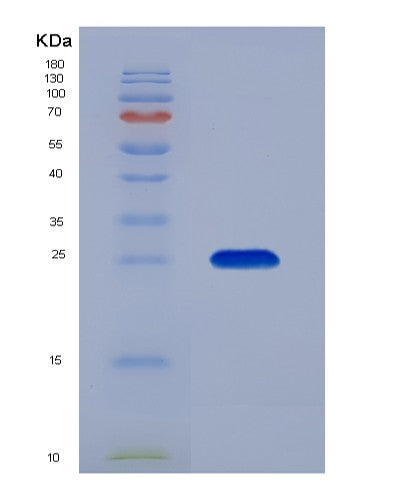 Human GPI (Glucose-6-Phosphate Isomerase) - Recombinant Protein