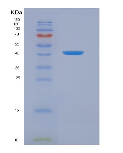 Human ANXA2 (Annexin A2) - Recombinant Protein
