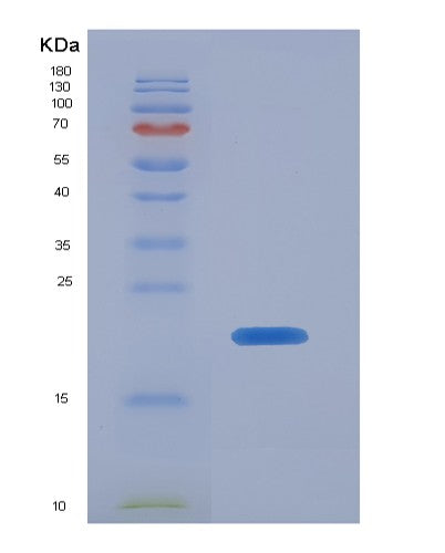 Human CTSL (Procathepsin L) - Recombinant Protein