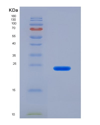 Human APRT (Adenine Phosphoribosyltransferase) - Recombinant Protein