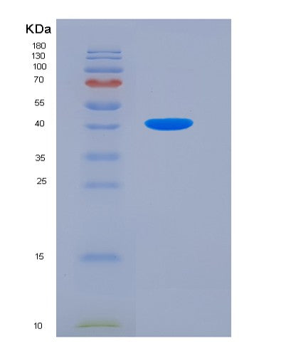Human TPM2 (Tropomyosin Beta Chain) - Recombinant Protein