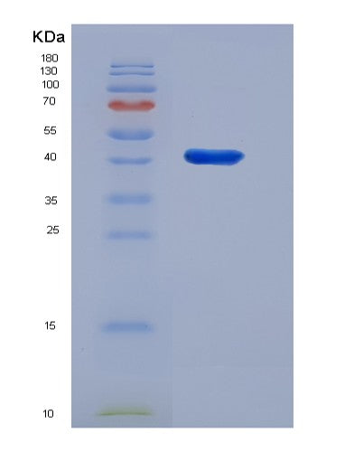 Mouse S100a10 (Protein S100-A10) - Recombinant Protein