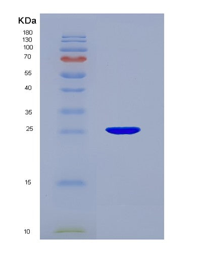 Human GSTA1 (Glutathione S-Transferase A1) - Recombinant Protein
