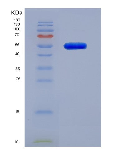 Human MMP3 (Stromelysin-1) - Recombinant Protein