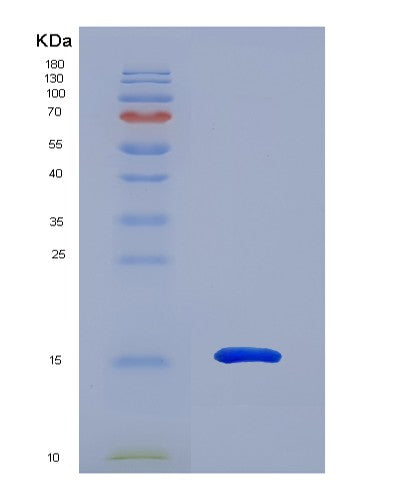 Human MGP (Matrix Gla Protein) - Recombinant Protein