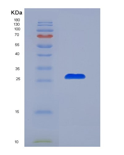 Mouse Il6 (Interleukin-6) - Recombinant Protein